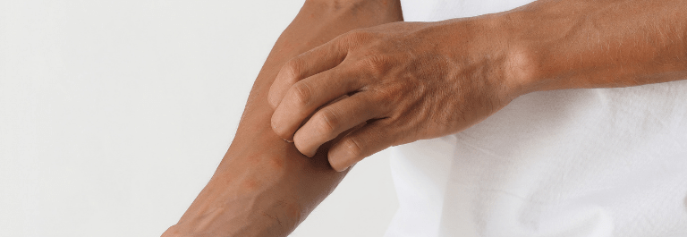 Are Skin Rashes Contagious?