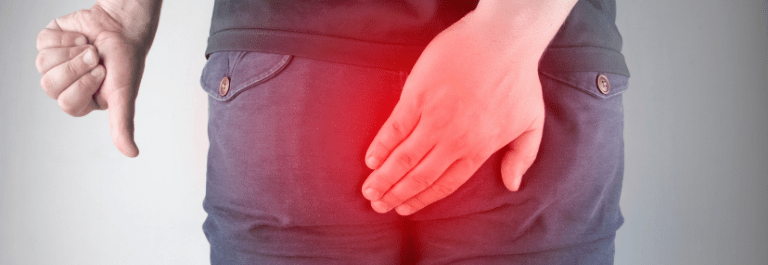Natural Treatments for Soothing Eczema Buttock Rash