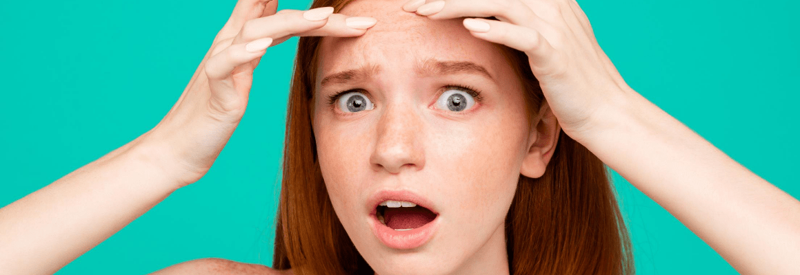 What You Should Know about Cystic Acne