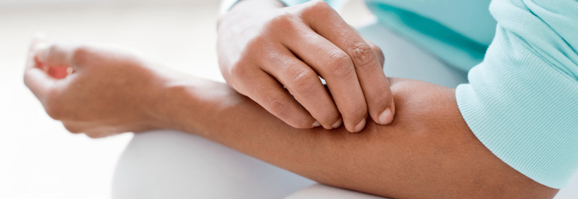 The Best Itchy Skin Relief