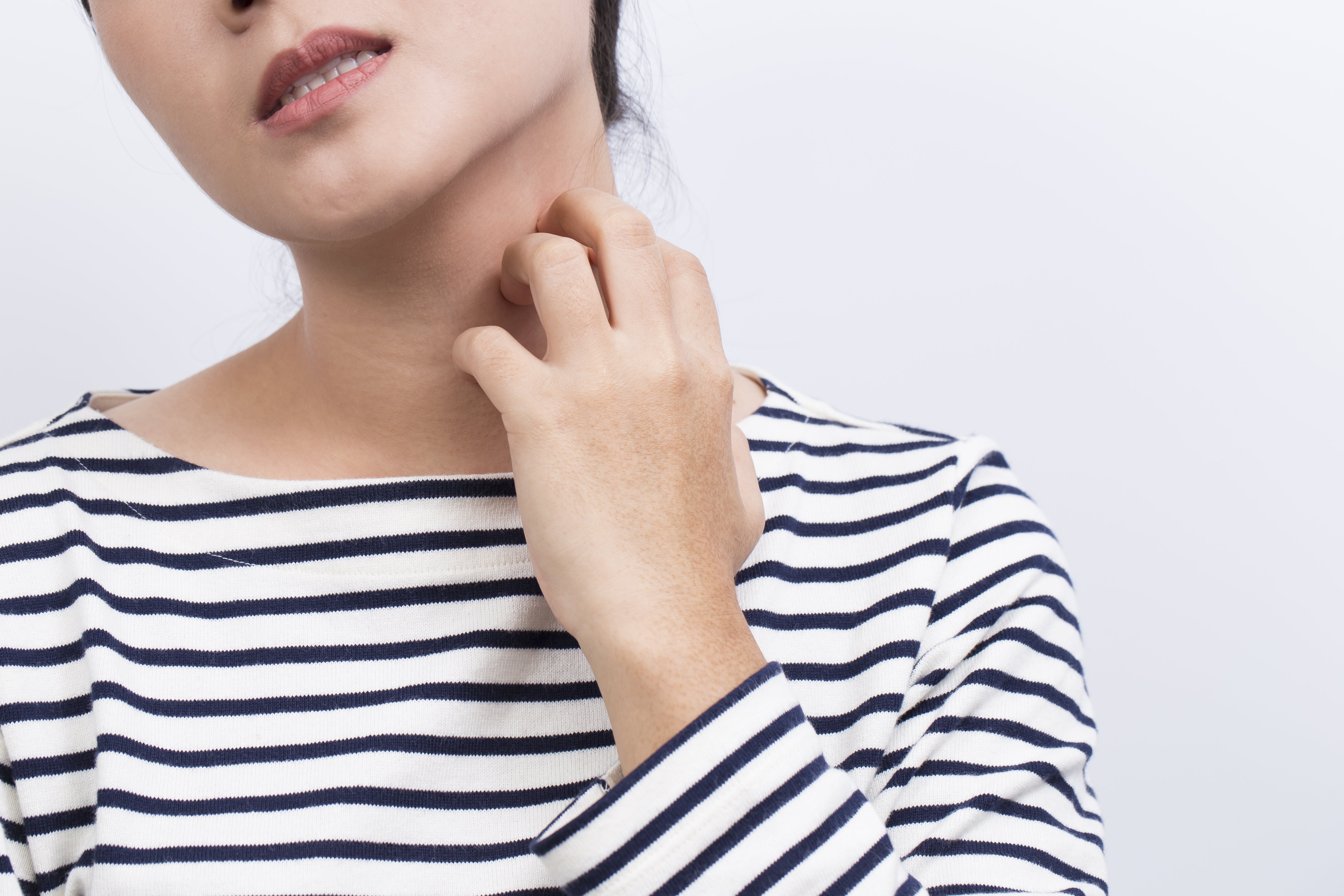 How to Treat Contact Dermatitis