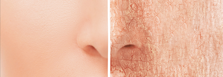 Can Dehydration Cause Skin Itching?