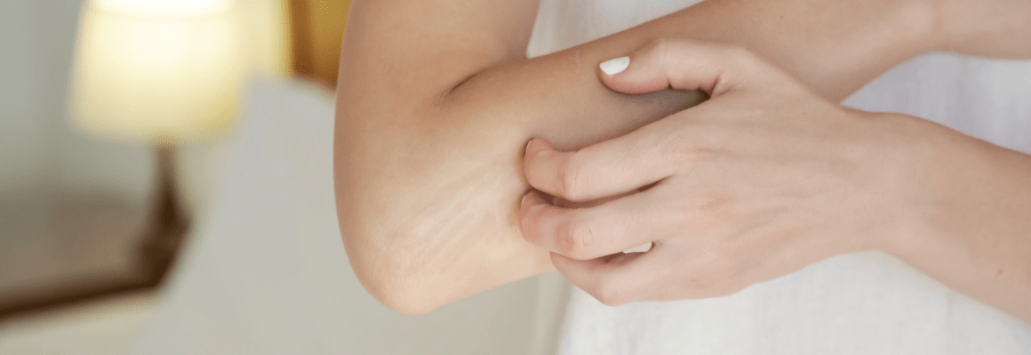 Your Guide to Natural Treatments for Itchy Skin