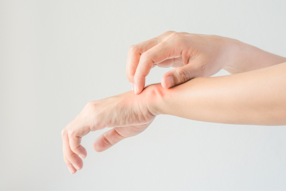 5 Tips to Help You Get a Grip on Hand Eczema