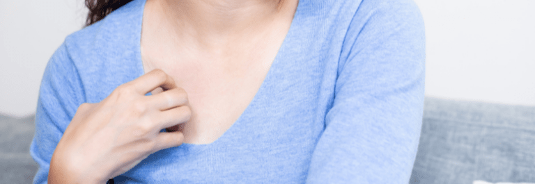 What To Do About Itchy Rashes on the Chest