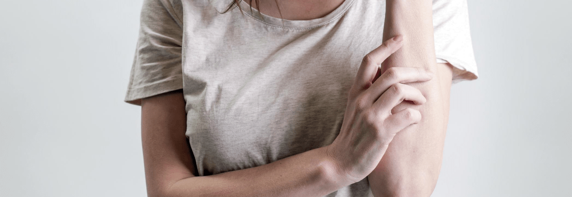 Keratosis Pilaris - woman scratching arm
