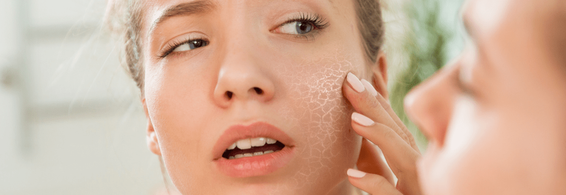 Why You Should Try this Natural Dry Skin Moisturizer