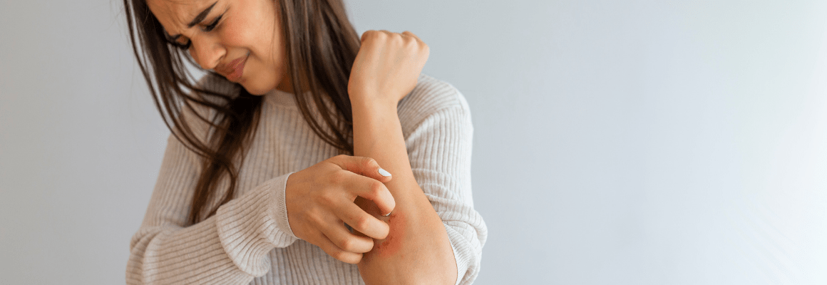 Psoriasis Triggers - woman wincing and scratching arm