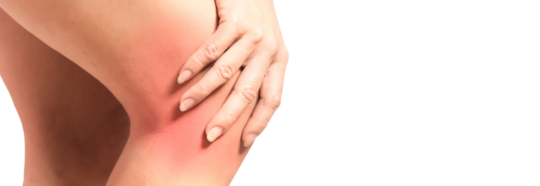 woman with rash behind the knees