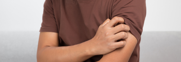 Man scratching upper arm: Understanding Pruritus Brachioradialis