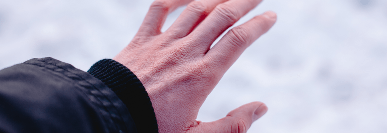 What to do About Dry Hands in Winter