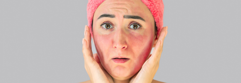 woman cupping her cheeks with worried expression 